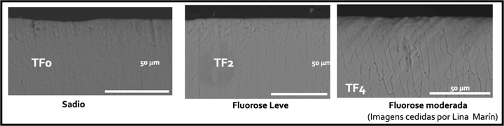 Fluorose 2